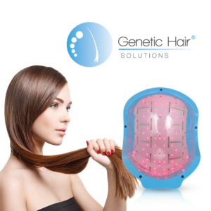 tratamiento alopecia mujer Genetic Hair